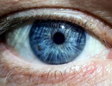 Σύνδρομο Sjögren: Η νόσος που προκαλεί ξηρότητα σε μάτια και στόμα